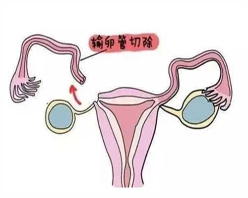 有人知道男性检查精子质量去医院该挂什么科吗？~试管试管婴儿助孕网